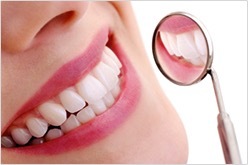 Beautiful white teeth after cosmetic dentistry